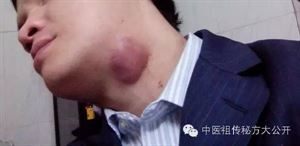 ܰͽƷ`ܰͽƫ~洫طܰͽ